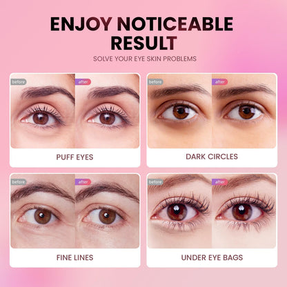 AILEORY Under Eye Patches (24 Pairs) - Tri-color Glitter Eye Gel Pads for Dark Circles, Puffy Eyes, Under eye Bags, Wrinkles - PrimeBioHealth - canada supplements