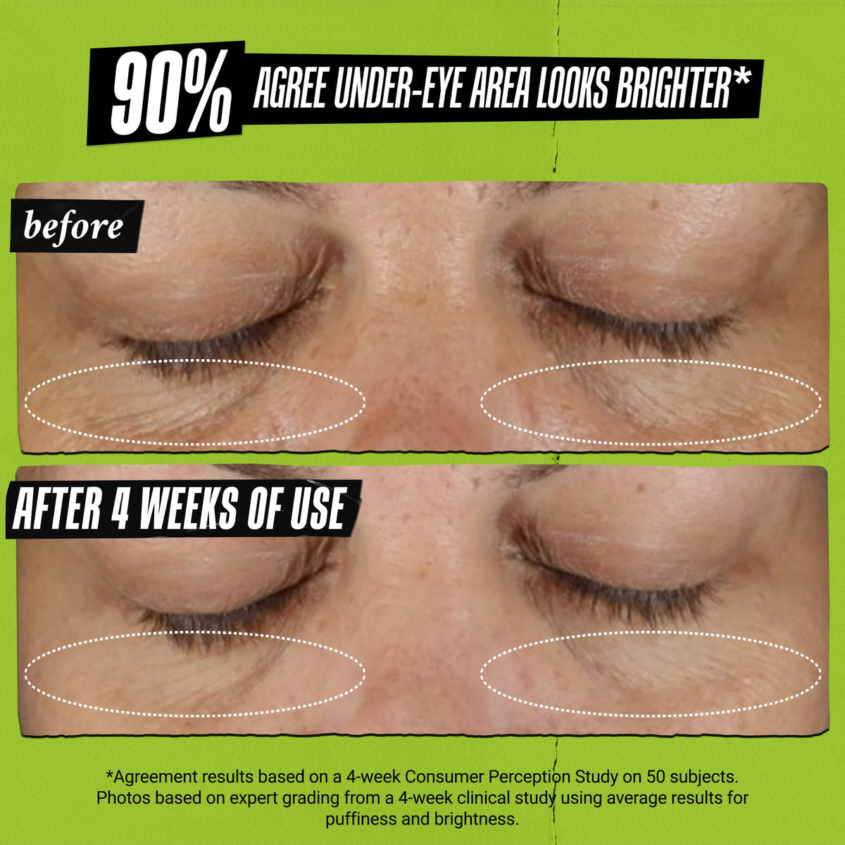 Kiehl's Avocado Eye Treatment, Nourishing and Hydrating Eye Cream, Avocado Oil and Caffeine to Energize and Invigorate Skin, Tired Eyes - PrimeBioHealth - canada supplements