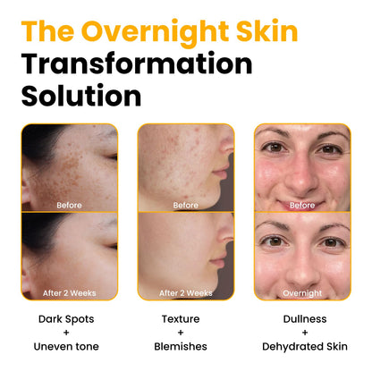 QUIA Turmeric + Kojic Acid Overnight Wrapping Mask – Hydration Mask for Glowing Skin - PrimeBioHealth - canada supplements